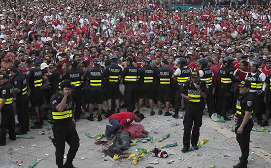 Costa Rica fans left lying in pools of blood at fan park