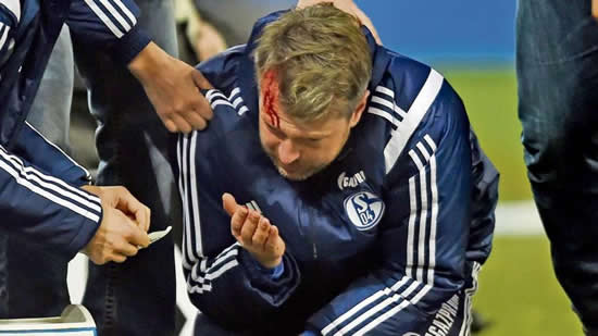 Schalke's assistant coach was busted open by a Zippo lighter v Cologne