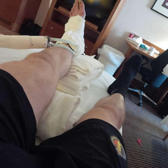 Simon Mignolet posts photo of injury suffered from Wayne Rooney tackle during Liverpool v Man United