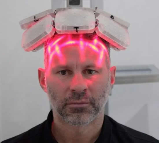 Ryan Giggs gets laser-zapping hair transplant after 'stress' of playing for Man United made him lose his locks