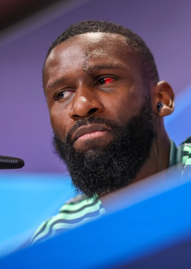 CORNEA BLIMEY Antonio Rudiger shows off gruesome red eye and 20 stitches in head after Real Madrid star’s injury vs Shakhtar Donetsk