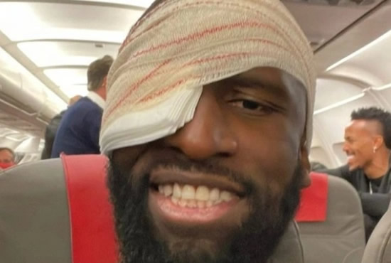 CORNEA BLIMEY Antonio Rudiger shows off gruesome red eye and 20 stitches in head after Real Madrid star’s injury vs Shakhtar Donetsk