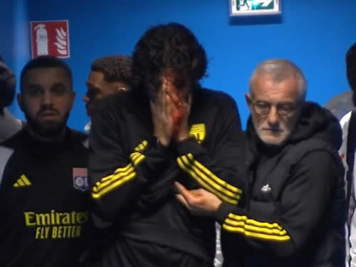 Lyon boss Fabio Grosso left with bloodied face after stone shatters bus window forcing Marseille clash to be abandoned